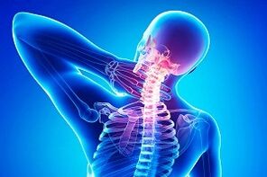 ओस्टियोचोन्ड्रोसिस के लक्षण के रूप में पीठ दर्द