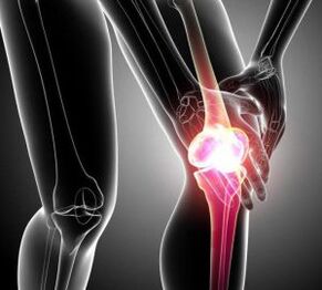गठिया और आर्थ्रोसिस में घुटने का दर्द